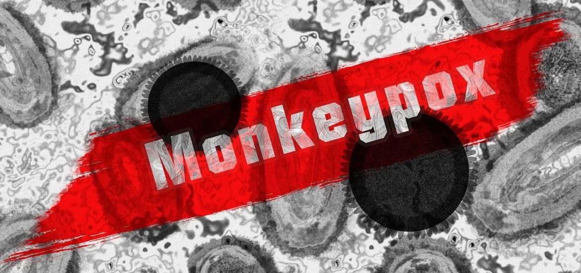 Monkeypox Treatments