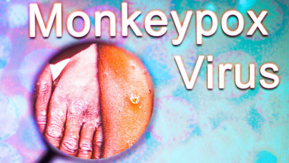 How Is Monkeypox Transmitted