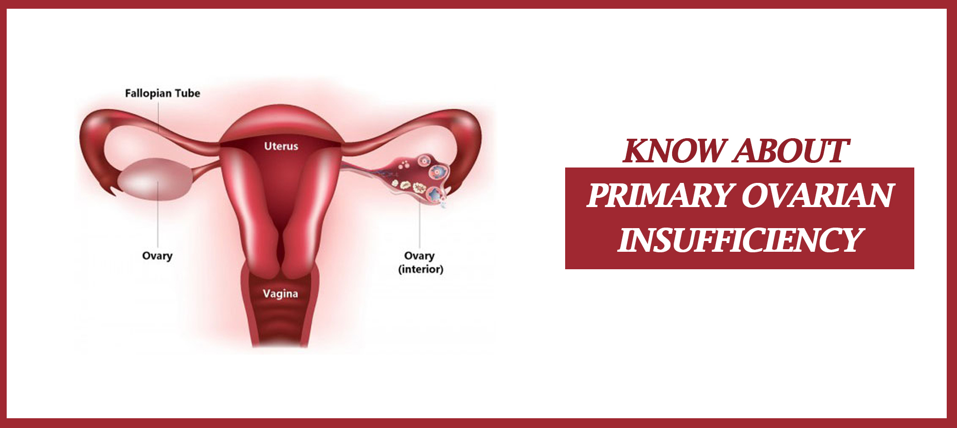 Primary Ovarian Insufficiency Symptoms