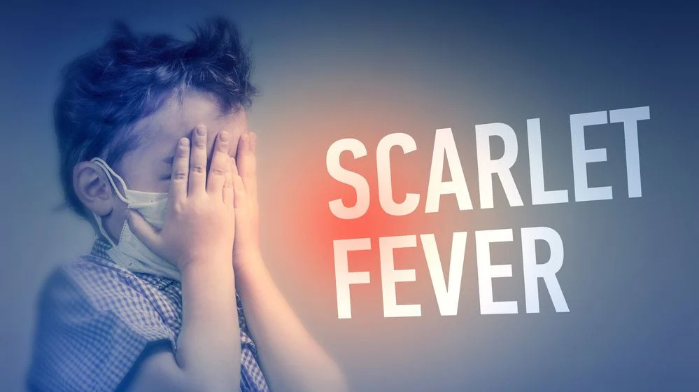 Scarlet Fever Symptoms